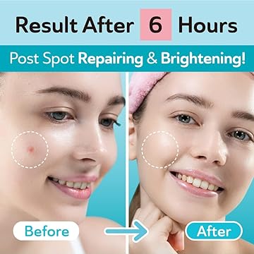 Before and after comparison of a woman's face with spot repairing and brightening effects after 6 hours.