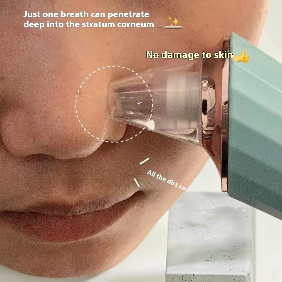 TheGromify electric pore vacuum with a mint green handle removing blackheads from a nose with gentle suction