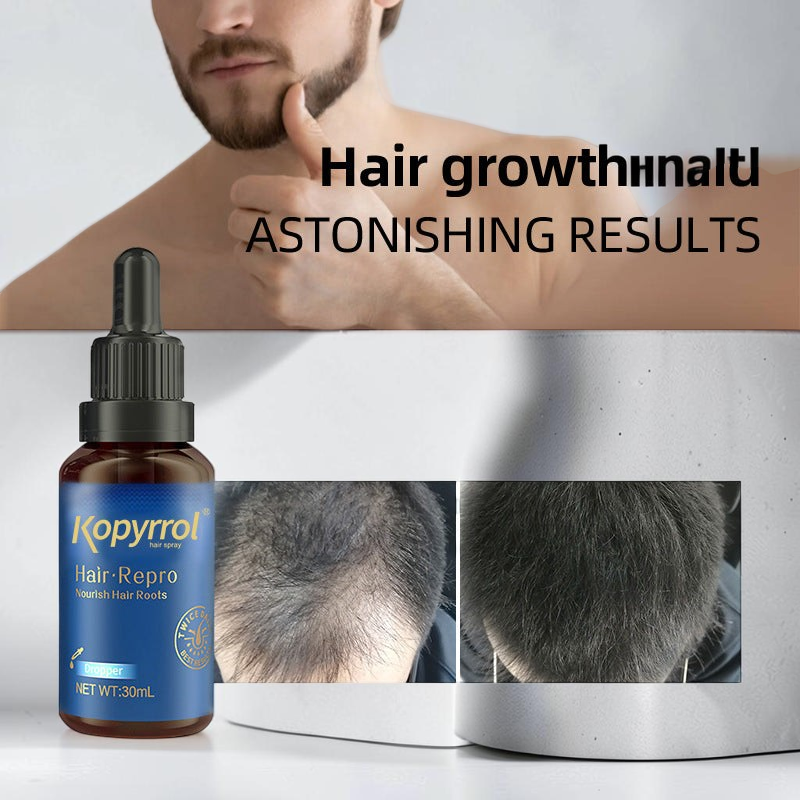TheGromify Hairline Strengthening Lotion bottle with before and after hair growth results and a man in the background.